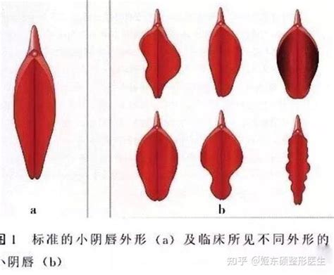 一線天小穴|女性陰部之形狀 （有11種）